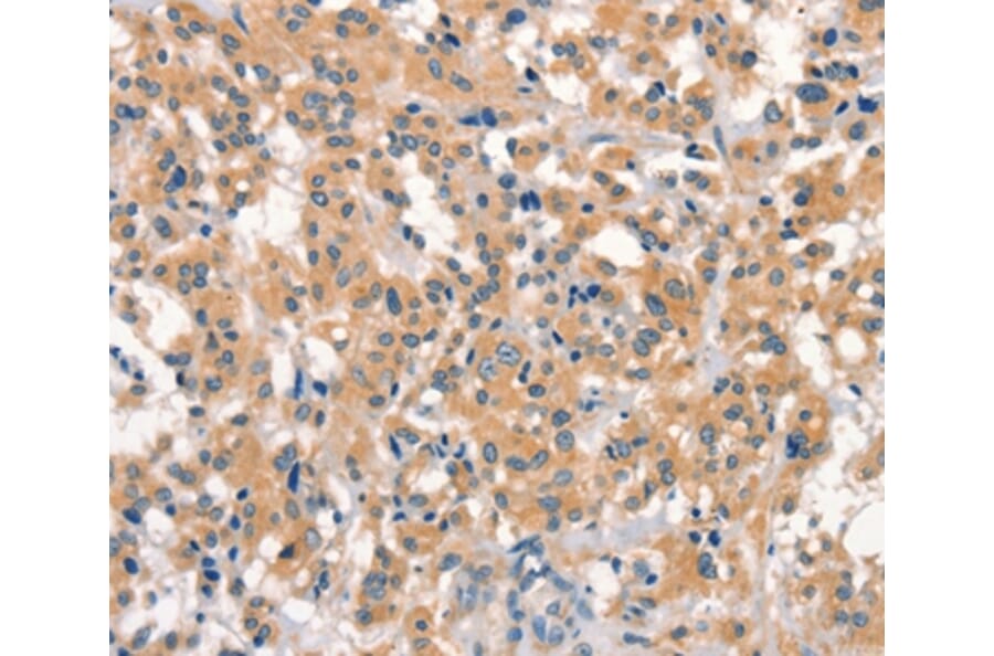 Immunohistochemistry - EID3 Antibody from Signalway Antibody (37542) - Antibodies.com