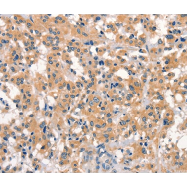 Immunohistochemistry - EID3 Antibody from Signalway Antibody (37542) - Antibodies.com