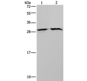ETFB Antibody from Signalway Antibody (37558) - Antibodies.com