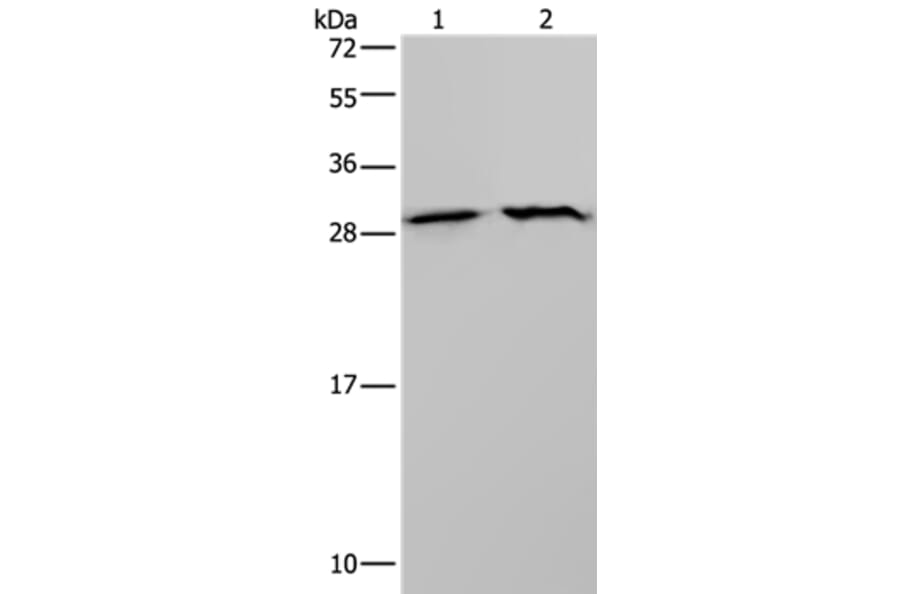 ETFB Antibody from Signalway Antibody (37558) - Antibodies.com