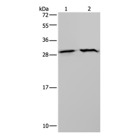 ETFB Antibody from Signalway Antibody (37558) - Antibodies.com