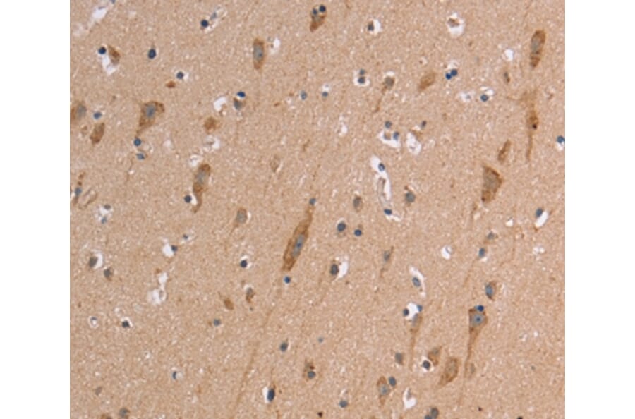 Immunohistochemistry - ETFB Antibody from Signalway Antibody (37558) - Antibodies.com