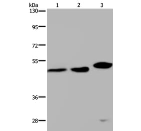 TDP2 Antibody from Signalway Antibody (37559) - Antibodies.com