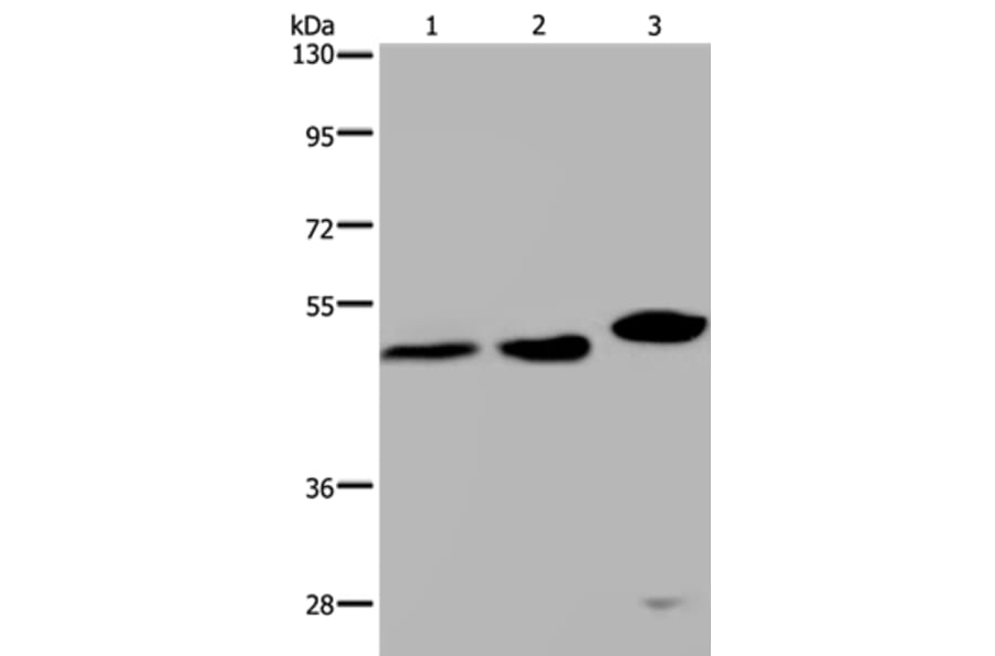 TDP2 Antibody from Signalway Antibody (37559) - Antibodies.com