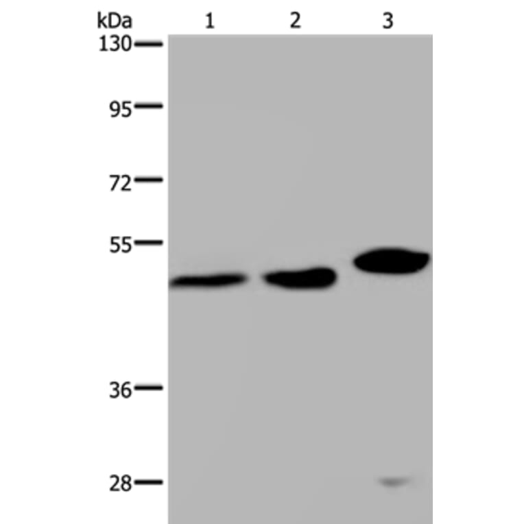 TDP2 Antibody from Signalway Antibody (37559) - Antibodies.com