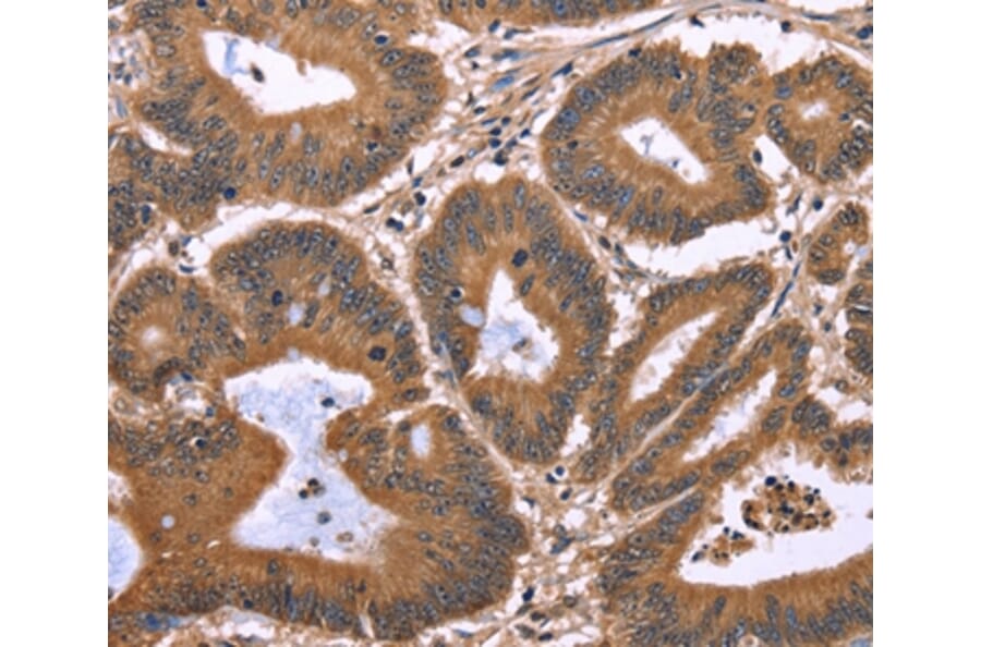 Immunohistochemistry - TDP2 Antibody from Signalway Antibody (37559) - Antibodies.com