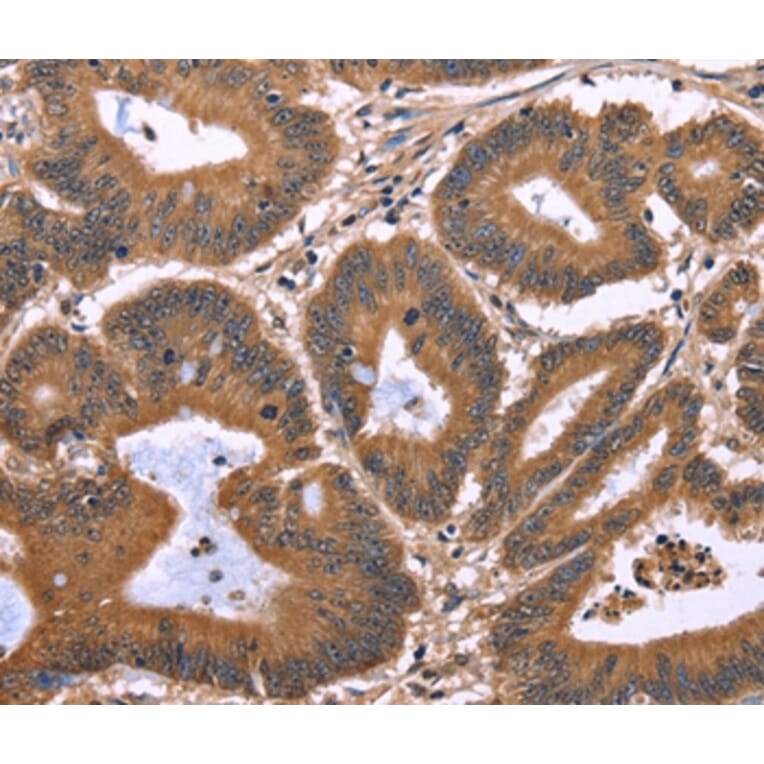 Immunohistochemistry - TDP2 Antibody from Signalway Antibody (37559) - Antibodies.com