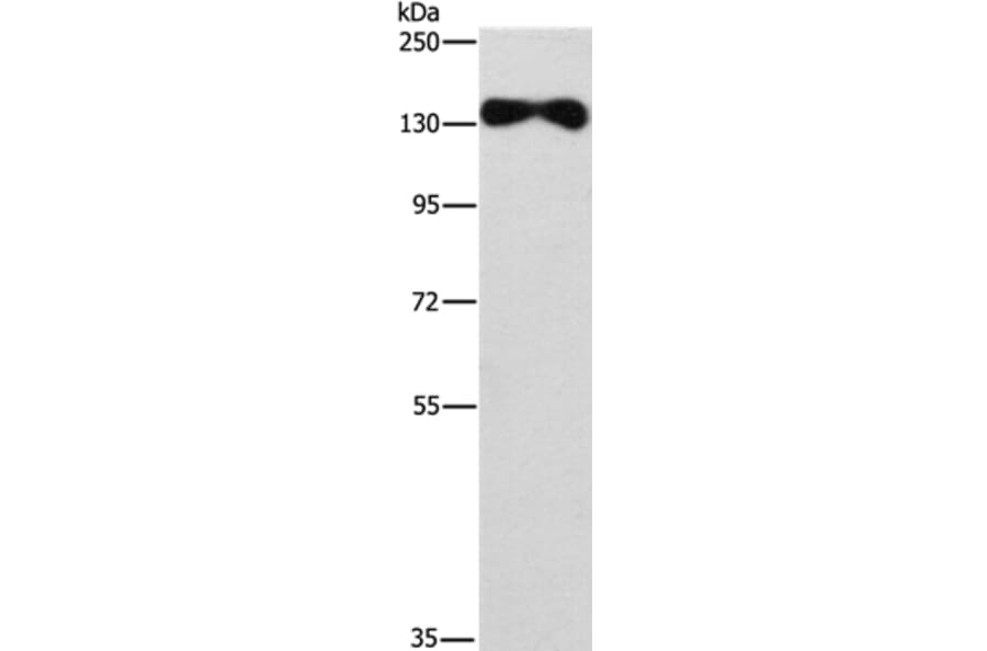 EVC2 Antibody from Signalway Antibody (37560) - Antibodies.com