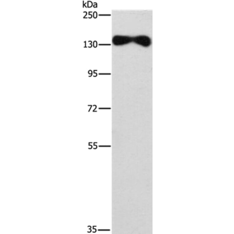 EVC2 Antibody from Signalway Antibody (37560) - Antibodies.com