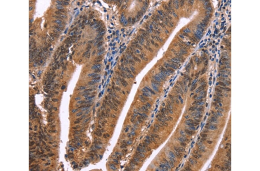 Immunohistochemistry - EVC2 Antibody from Signalway Antibody (37560) - Antibodies.com