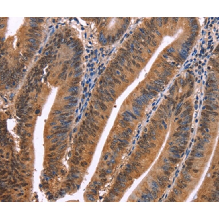 Immunohistochemistry - EVC2 Antibody from Signalway Antibody (37560) - Antibodies.com