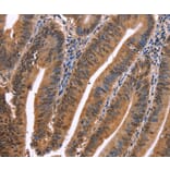 Immunohistochemistry - EVC2 Antibody from Signalway Antibody (37560) - Antibodies.com
