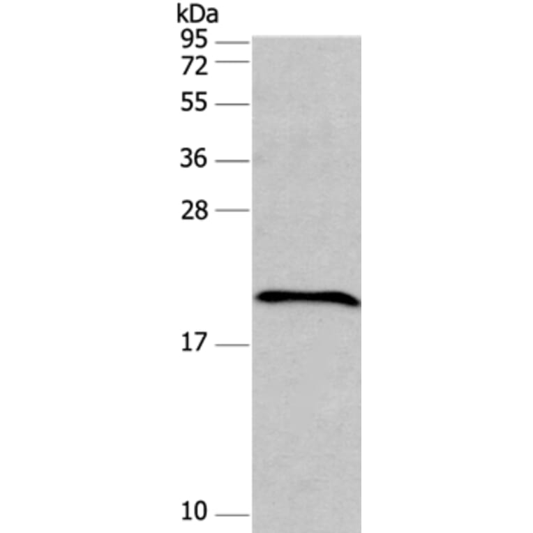 FAIM Antibody from Signalway Antibody (37562) - Antibodies.com