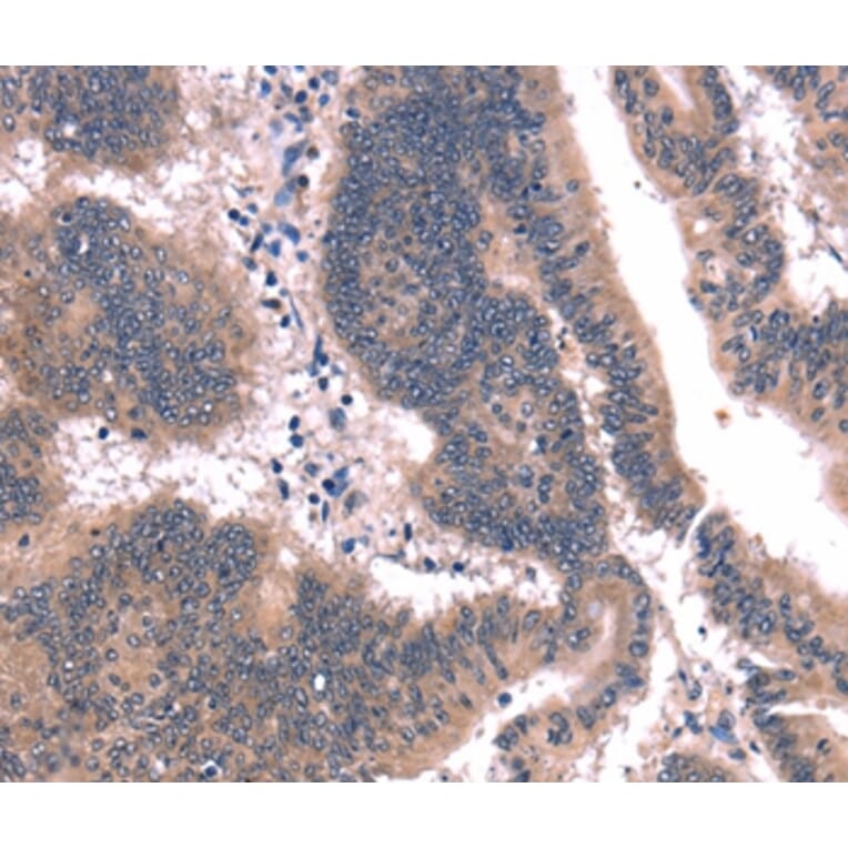 Immunohistochemistry - FAIM Antibody from Signalway Antibody (37562) - Antibodies.com