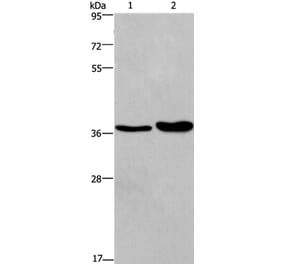 FUT1 Antibody from Signalway Antibody (37578) - Antibodies.com