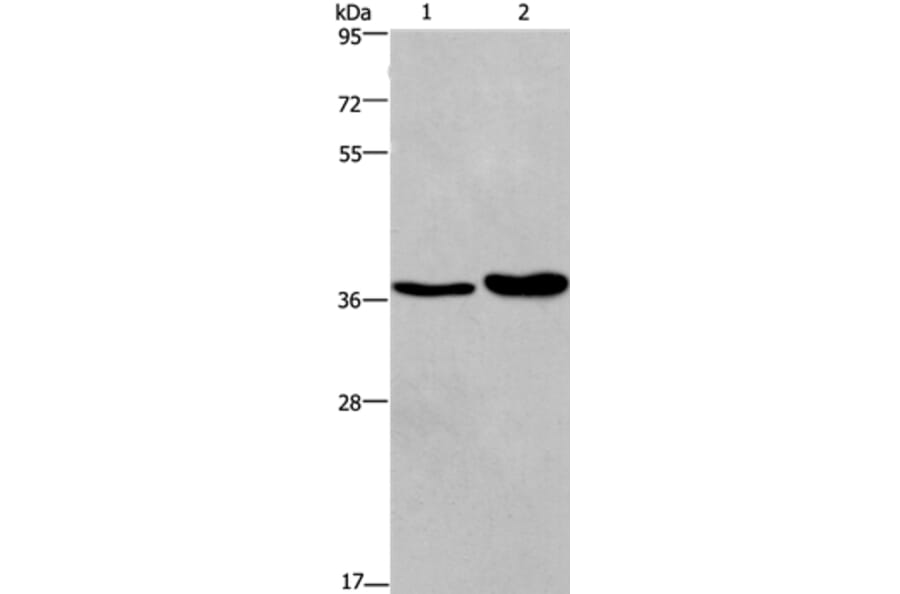 FUT1 Antibody from Signalway Antibody (37578) - Antibodies.com