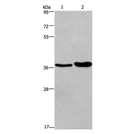 FUT1 Antibody from Signalway Antibody (37578) - Antibodies.com