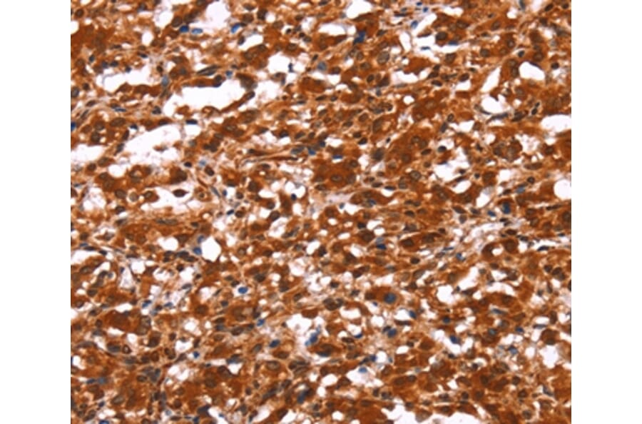 Immunohistochemistry - FUT1 Antibody from Signalway Antibody (37578) - Antibodies.com