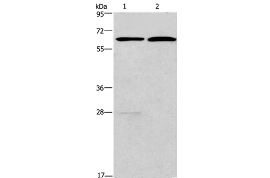 FUT8 Antibody from Signalway Antibody (37579) - Antibodies.com