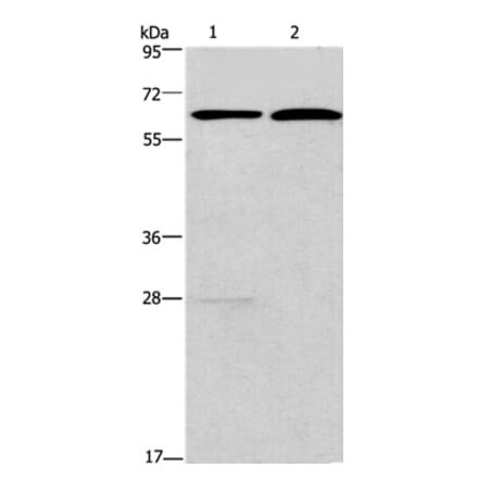 FUT8 Antibody from Signalway Antibody (37579) - Antibodies.com