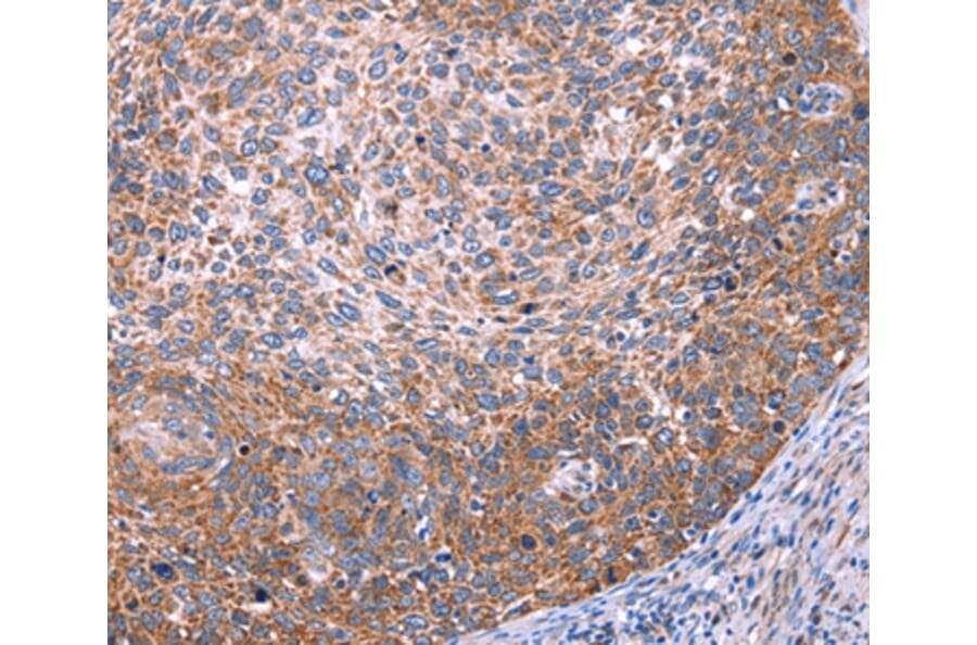 Immunohistochemistry - FUT8 Antibody from Signalway Antibody (37579) - Antibodies.com