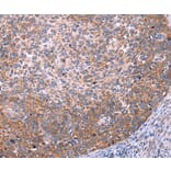 Immunohistochemistry - FUT8 Antibody from Signalway Antibody (37579) - Antibodies.com