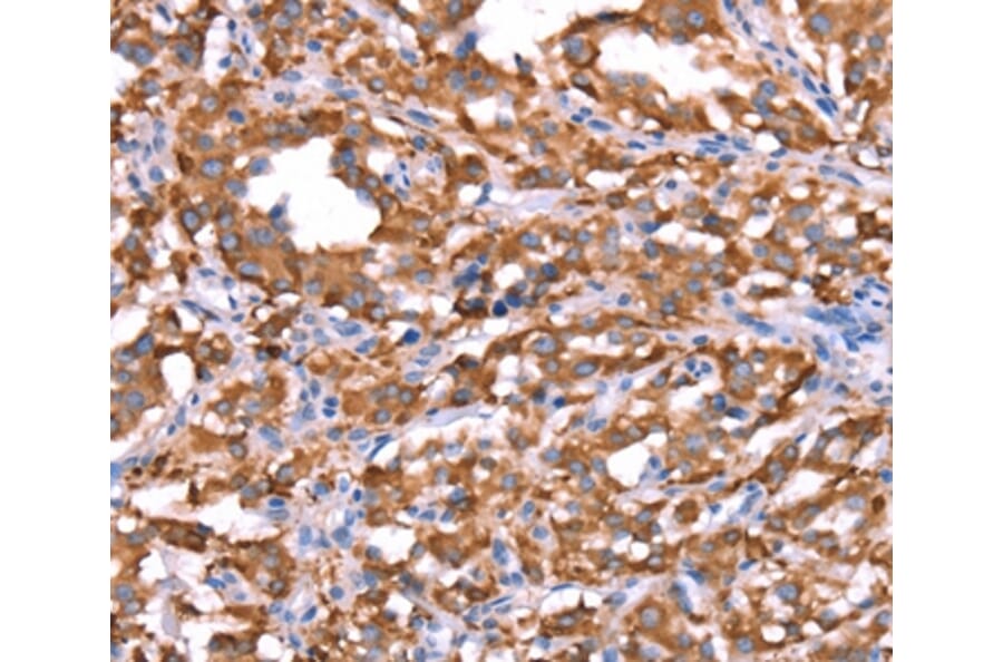 Immunohistochemistry - FXR1 Antibody from Signalway Antibody (37580) - Antibodies.com