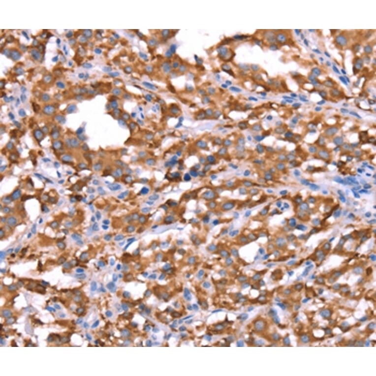 Immunohistochemistry - FXR1 Antibody from Signalway Antibody (37580) - Antibodies.com