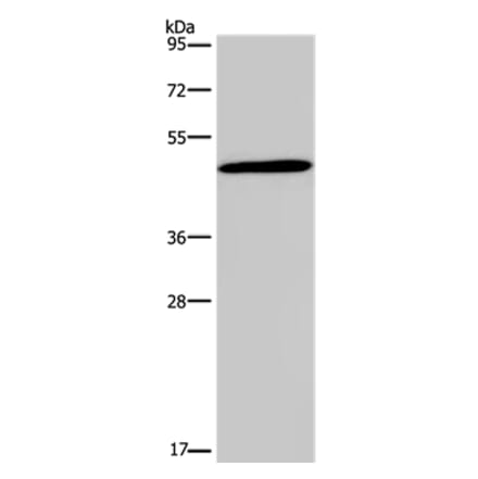 GCGR Antibody from Signalway Antibody (37596) - Antibodies.com