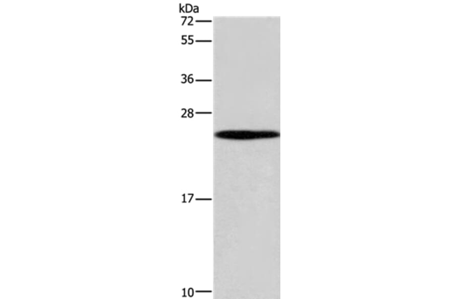 GUK1 Antibody from Signalway Antibody (37611) - Antibodies.com