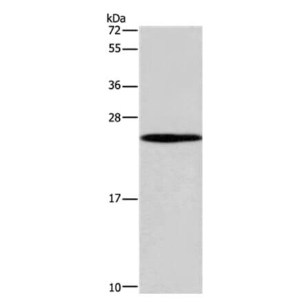 GUK1 Antibody from Signalway Antibody (37611) - Antibodies.com