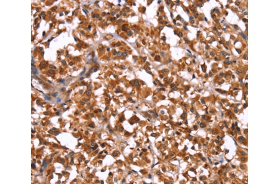 Immunohistochemistry - GUK1 Antibody from Signalway Antibody (37611) - Antibodies.com