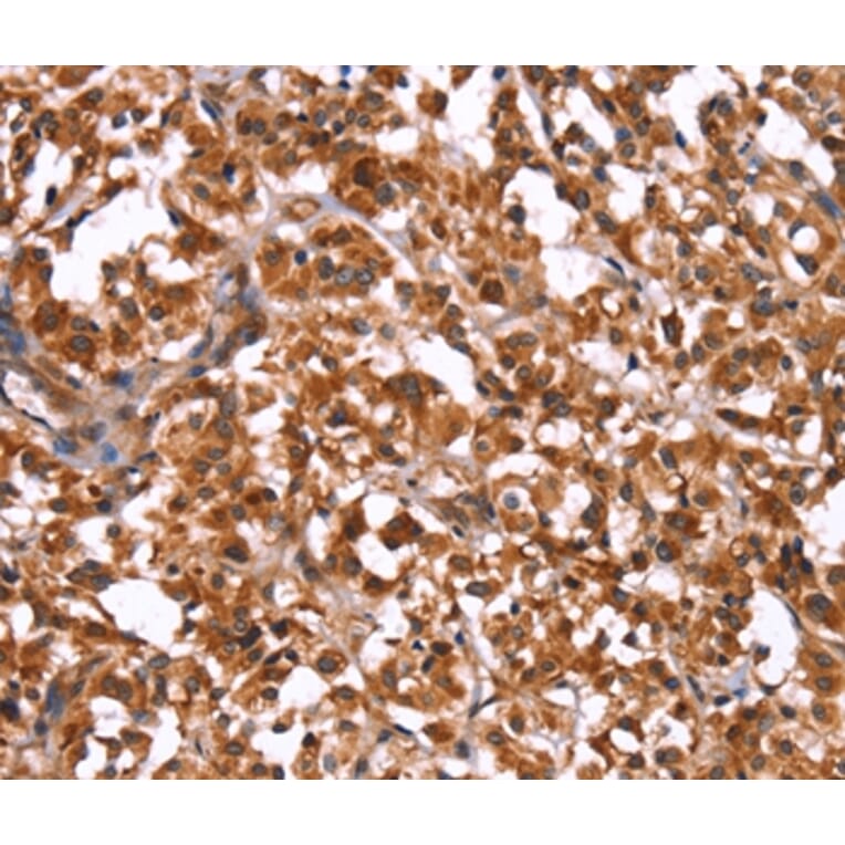 Immunohistochemistry - GUK1 Antibody from Signalway Antibody (37611) - Antibodies.com