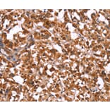 Immunohistochemistry - GUK1 Antibody from Signalway Antibody (37611) - Antibodies.com