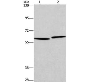 HAS1 Antibody from Signalway Antibody (37613) - Antibodies.com