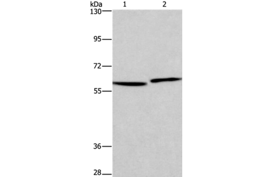 HAS1 Antibody from Signalway Antibody (37613) - Antibodies.com