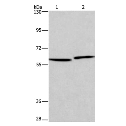 HAS1 Antibody from Signalway Antibody (37613) - Antibodies.com