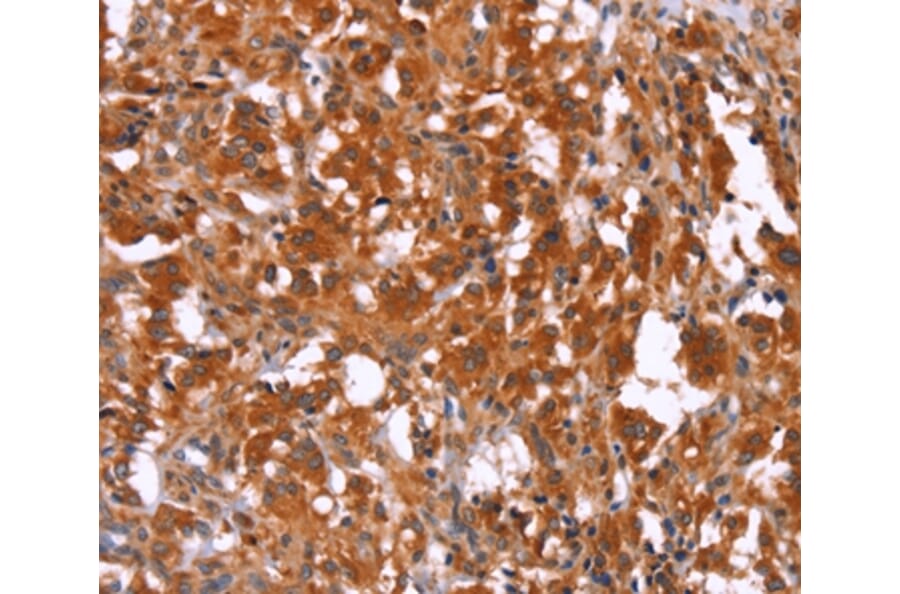 Immunohistochemistry - HAS1 Antibody from Signalway Antibody (37613) - Antibodies.com