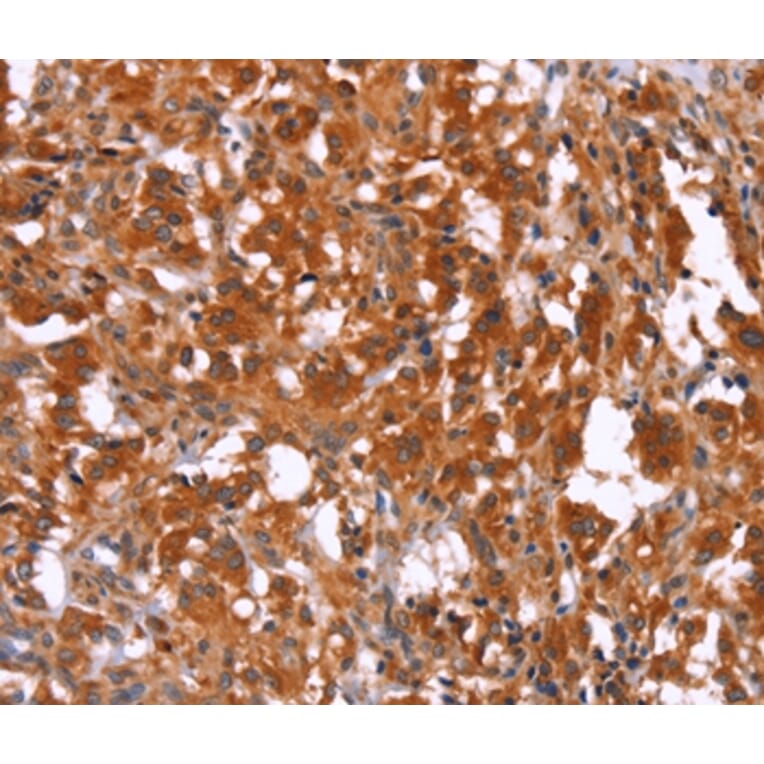 Immunohistochemistry - HAS1 Antibody from Signalway Antibody (37613) - Antibodies.com