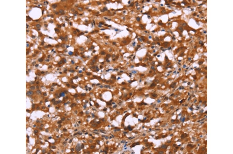Immunohistochemistry - BRK1 Antibody from Signalway Antibody (37618) - Antibodies.com