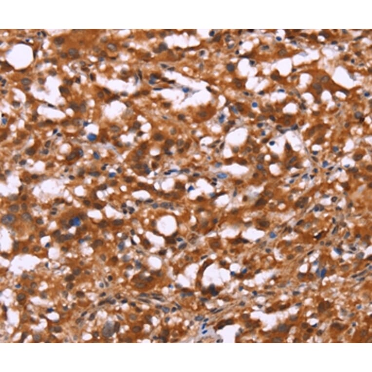 Immunohistochemistry - BRK1 Antibody from Signalway Antibody (37618) - Antibodies.com