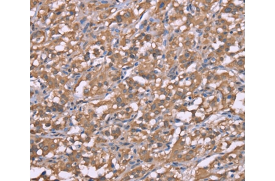 Immunohistochemistry - HRH3 Antibody from Signalway Antibody (37632) - Antibodies.com