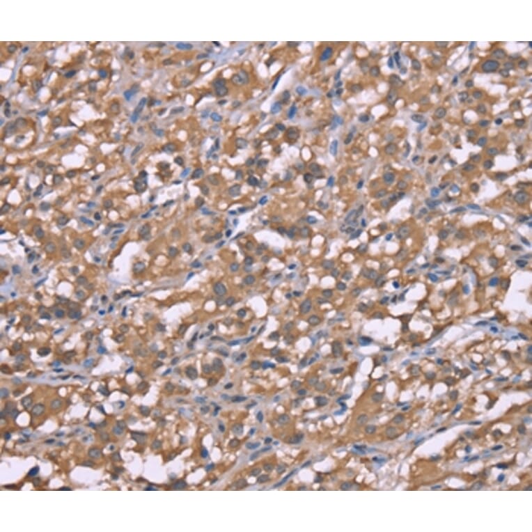 Immunohistochemistry - HRH3 Antibody from Signalway Antibody (37632) - Antibodies.com