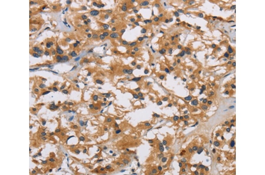 Immunohistochemistry - IL19 Antibody from Signalway Antibody (37650) - Antibodies.com