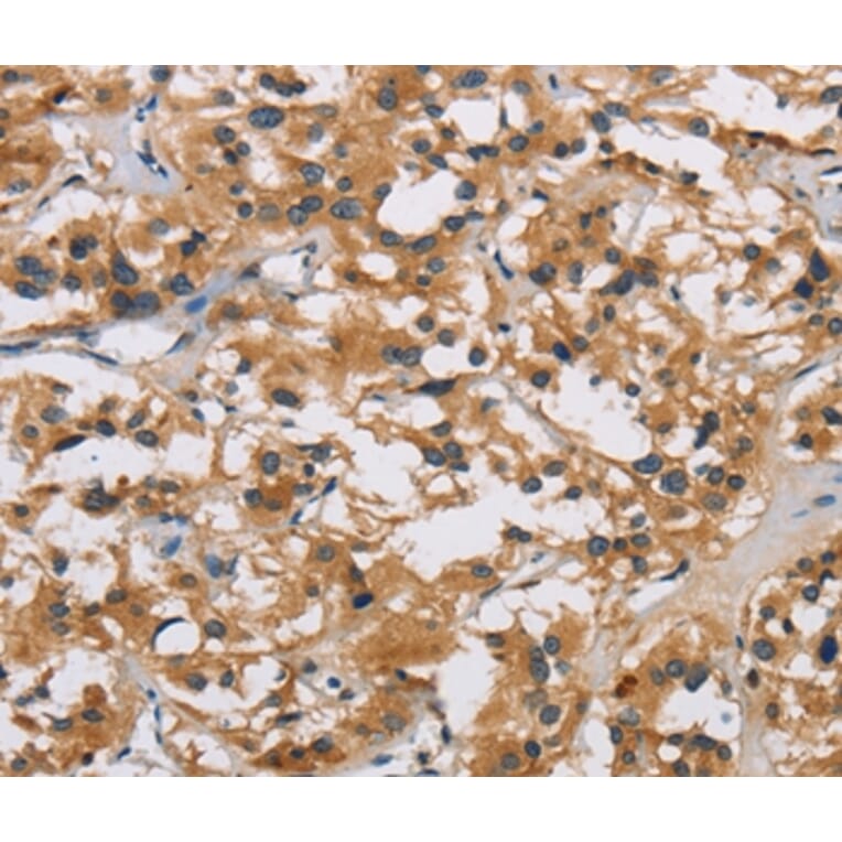 Immunohistochemistry - IL19 Antibody from Signalway Antibody (37650) - Antibodies.com