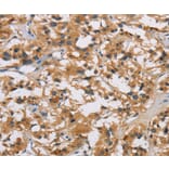 Immunohistochemistry - IL19 Antibody from Signalway Antibody (37650) - Antibodies.com