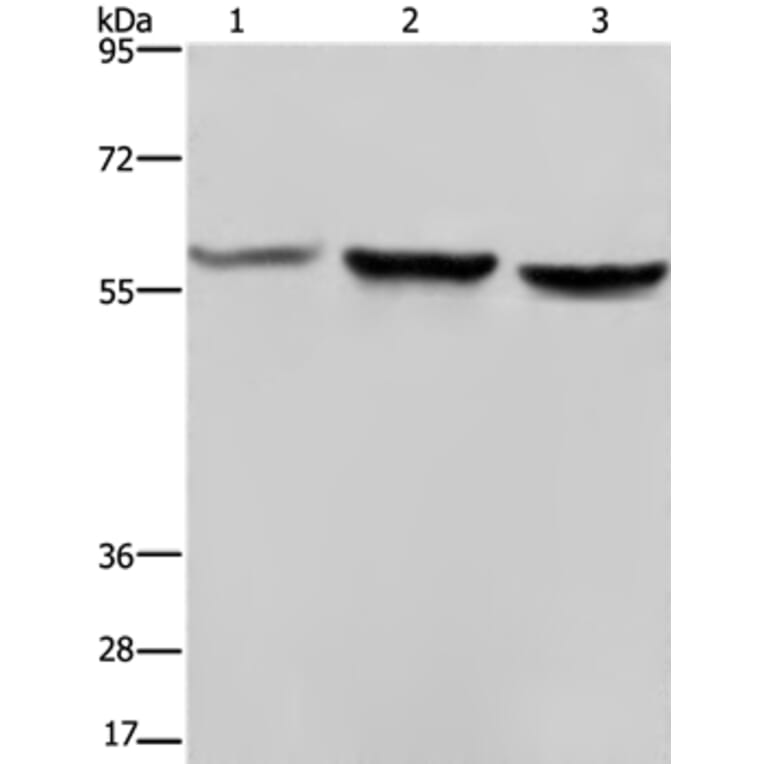 SYN2 Antibody from Signalway Antibody (37653) - Antibodies.com