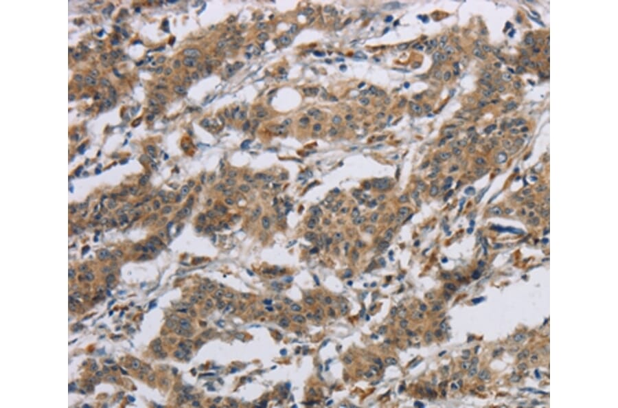 Immunohistochemistry - SYN2 Antibody from Signalway Antibody (37653) - Antibodies.com