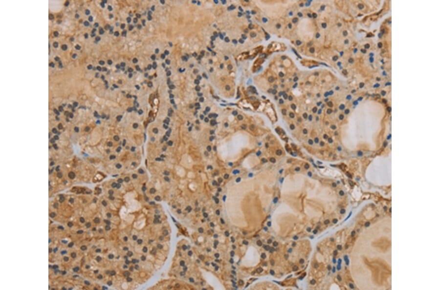 Immunohistochemistry - IPO9 Antibody from Signalway Antibody (37657) - Antibodies.com