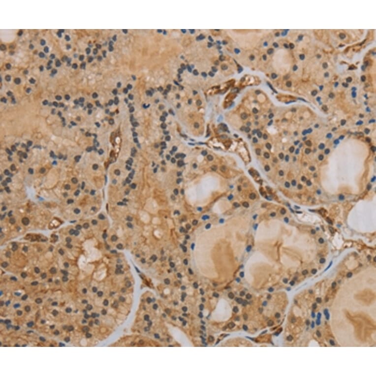 Immunohistochemistry - IPO9 Antibody from Signalway Antibody (37657) - Antibodies.com